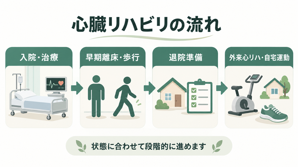 入院と治療から早期離床、退院準備、外来心臓リハビリと自宅運動までの流れ