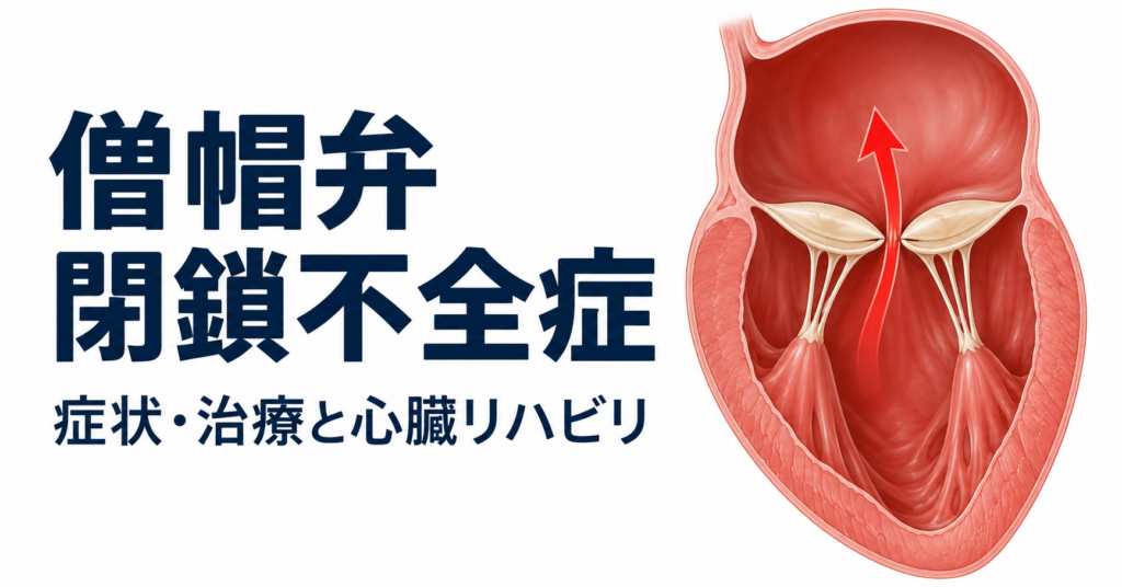 僧帽弁閉鎖不全症 症状・治療と心臓リハビリ」の文字と、左心室から左心房への逆流を示す模式図