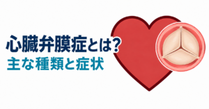 「心臓弁膜症とは？ 主な種類と症状」の文字と、心臓のシンボルおよび弁の模式図